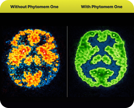 Illustration of the Phytomem One dual-mechanism approach to brain and memory support
